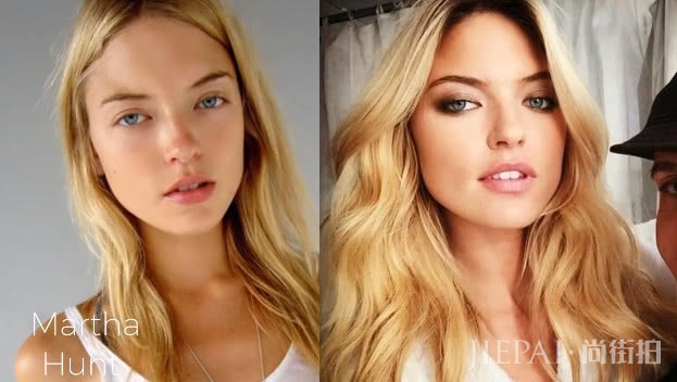 ά����ʹ���մ��ƴ����ǰ�󷴲�̫��ж��ױ�������㻹�Ұ���